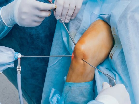 Arthroscopy & Arthroplasty