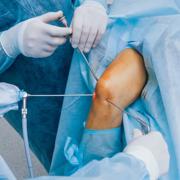 Arthroscopy & Arthroplasty