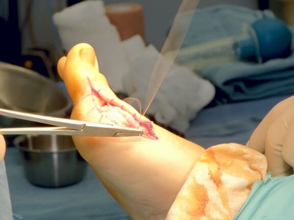 Foot & Ankle Surgery