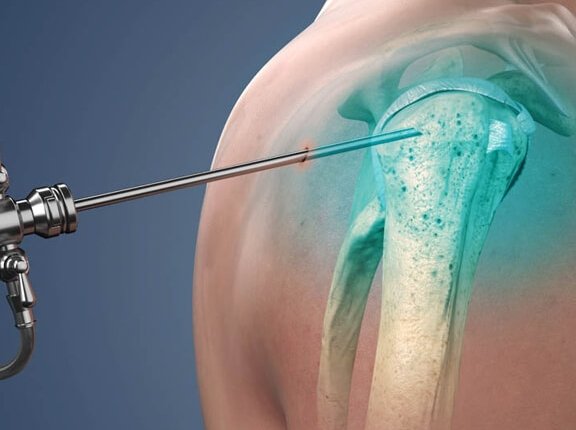 Knee & Shoulder Surgery