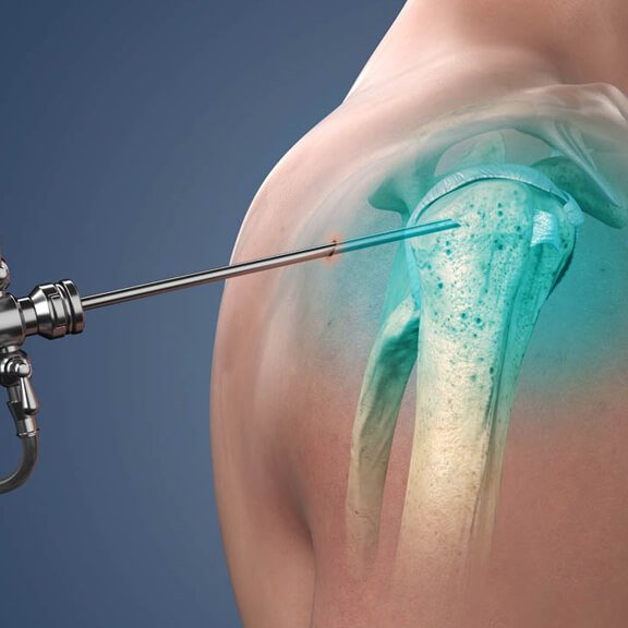 Knee & Shoulder Surgery